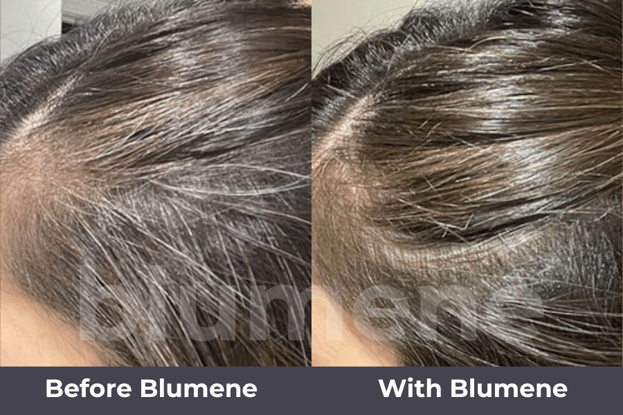 Blumene Blumiq™ Hair Serum
